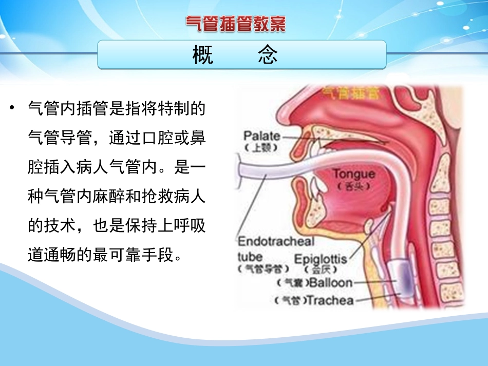气管插管教案_第2页