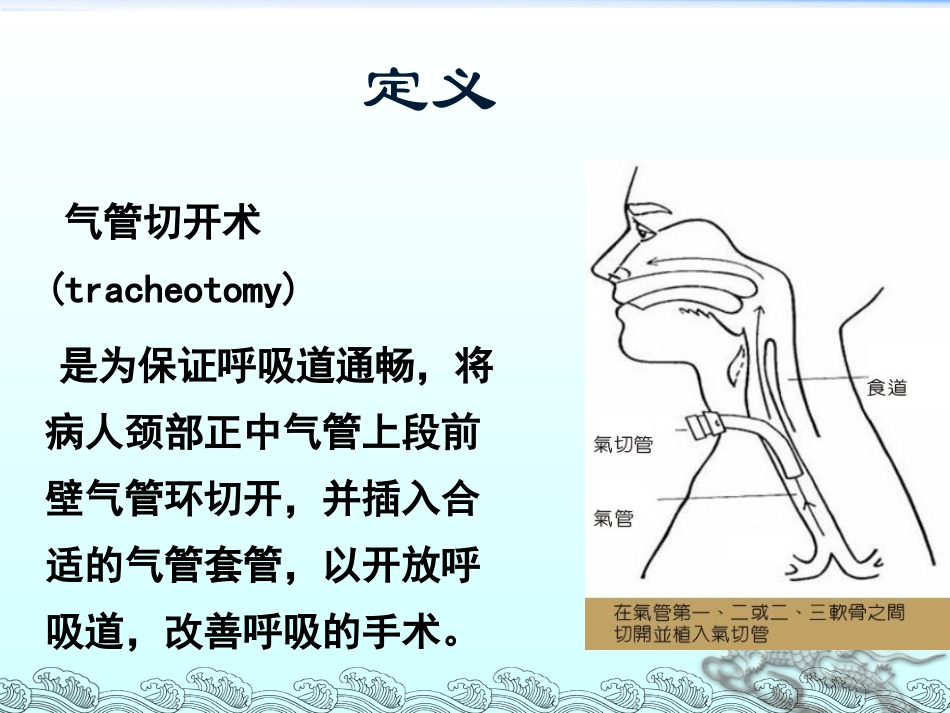 气管切开的操作_第3页