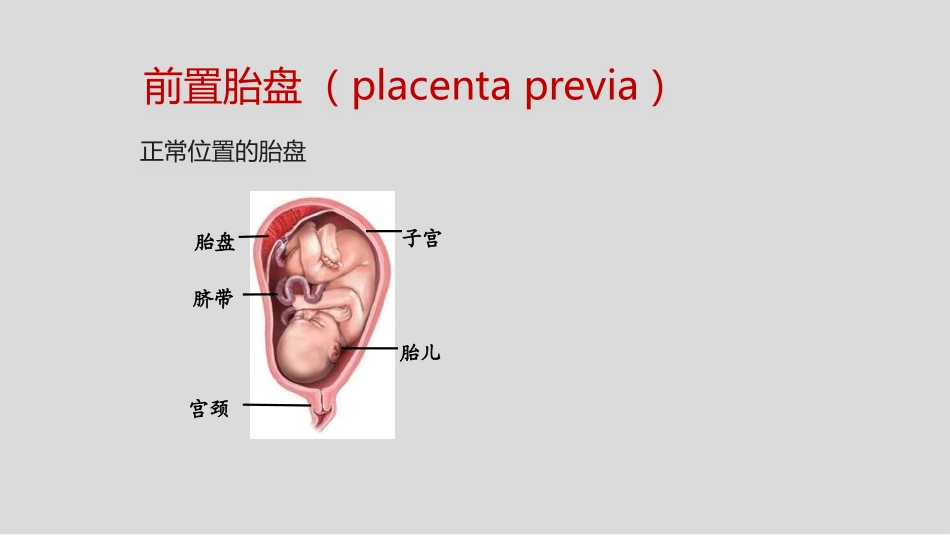 前置胎盘和胎盘植入影像表现_第1页