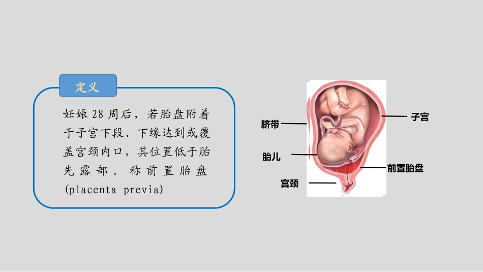 前置胎盘和胎盘植入影像表现_第2页