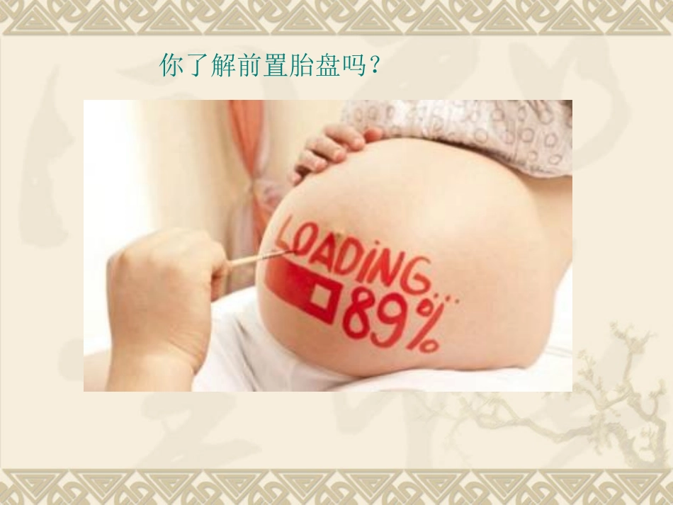 前置胎盘护理查房_第2页