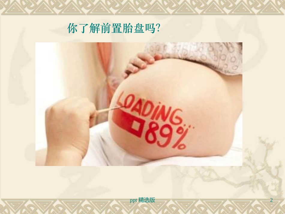 前置胎盘护理查房课件_第2页