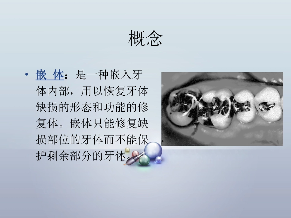 嵌体包括图解_第2页