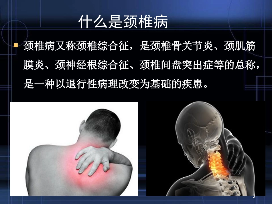 青少年颈椎病的防治幻灯片课件_第2页