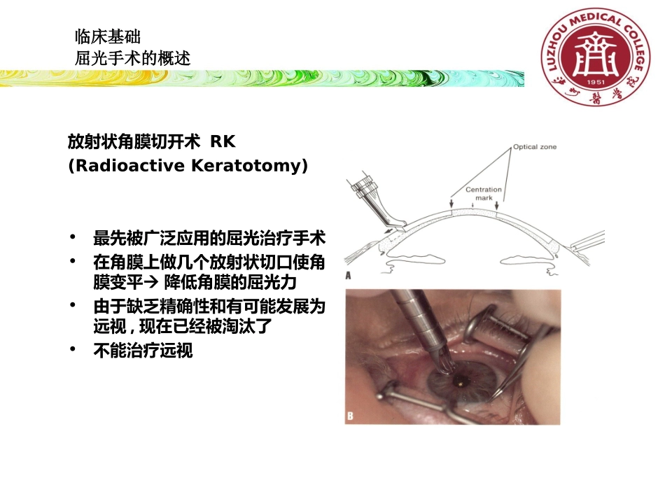 屈光手术选择吕红彬_第3页
