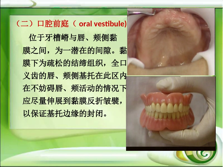 全口无牙颌解剖标志的识别_第3页