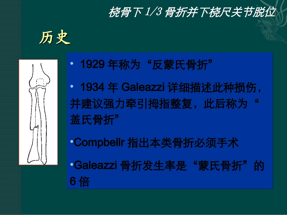 桡骨下骨折合并下桡尺关节脱位_第3页