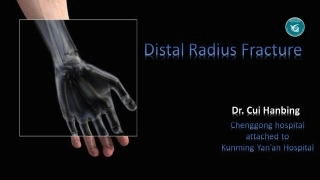 桡骨远端骨折精美版
