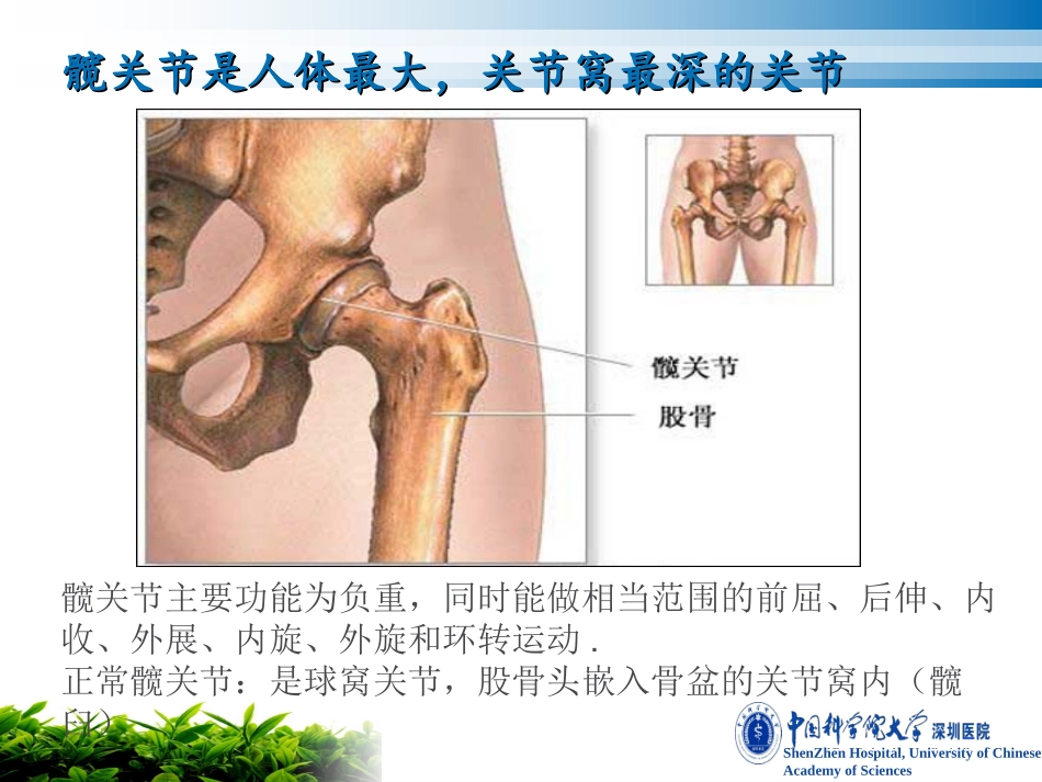 人工髋关节置换术的护理_第3页