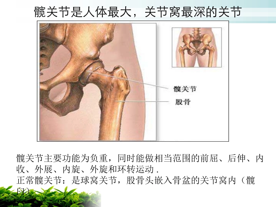 人工髋关节置换术后的护理资料_第3页