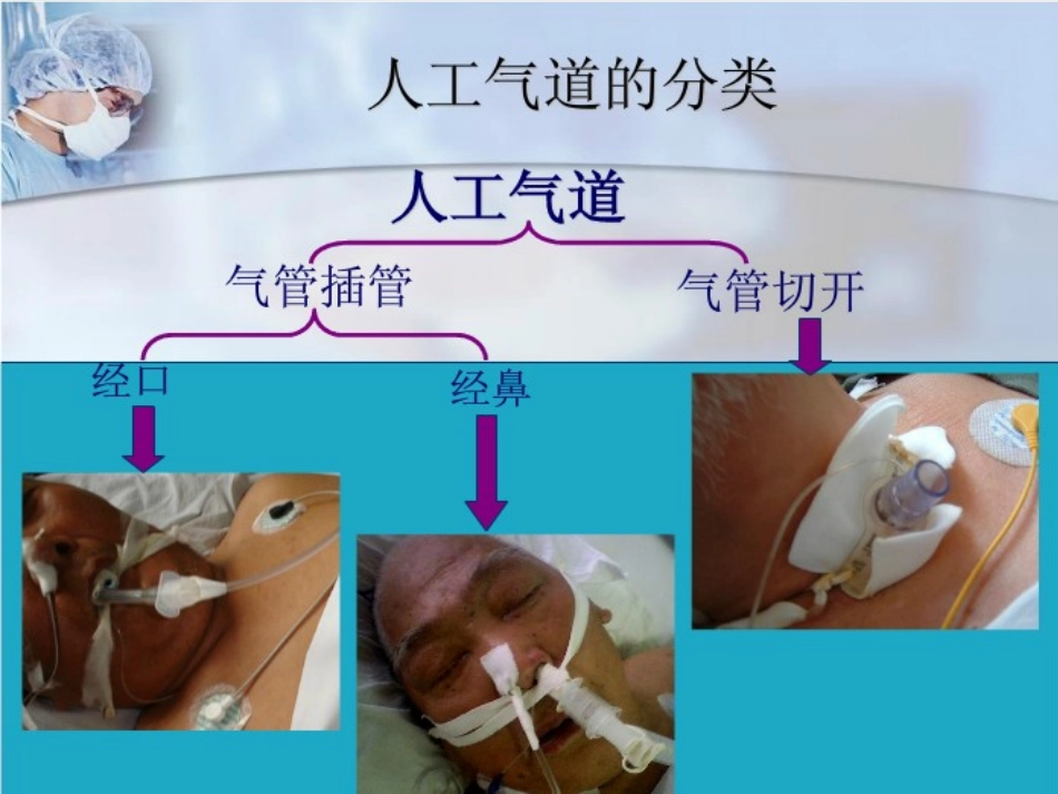 人工气道管理解读_第3页