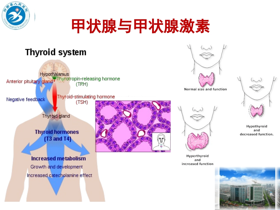 妊娠甲状腺毒症概述_第3页