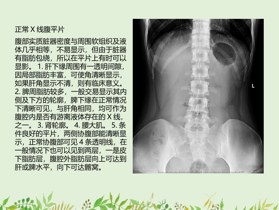 如何观察腹部X线平片腹部X线平片常见病的诊疗_第3页