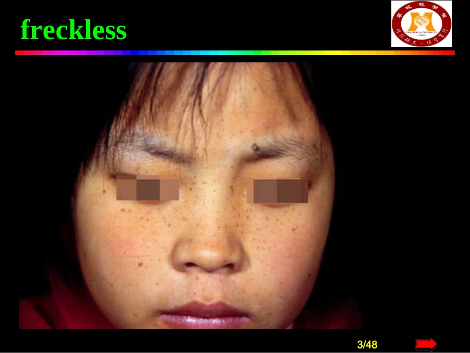 色素障碍性皮肤病_第3页