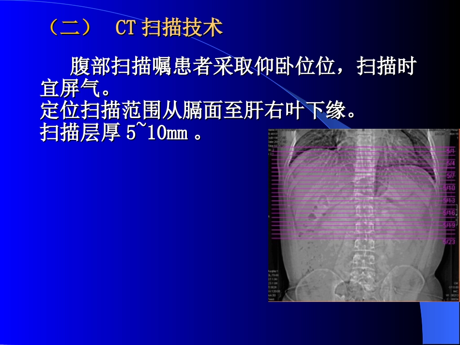 上腹部CT肝胆脾胰检查技术课件_第3页