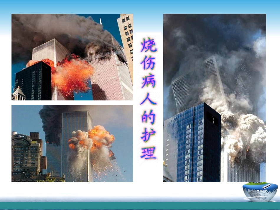 烧伤病人的护理完整版本_第1页