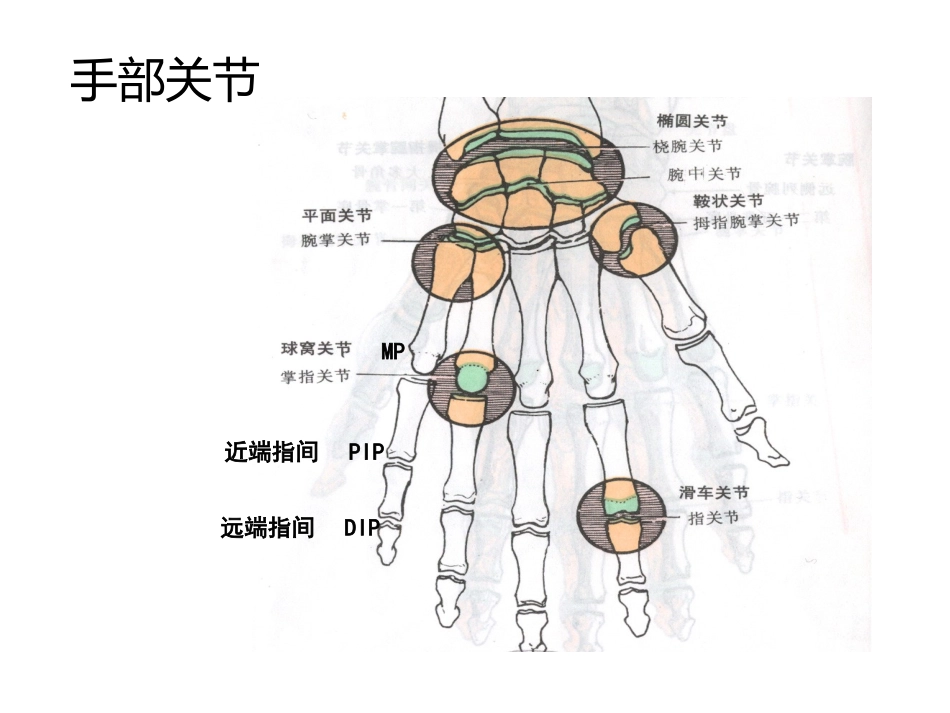 伸屈指肌腱断裂术后康复_第3页