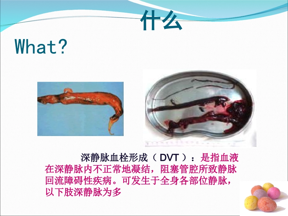 深度静脉血栓的预防及护理_第3页