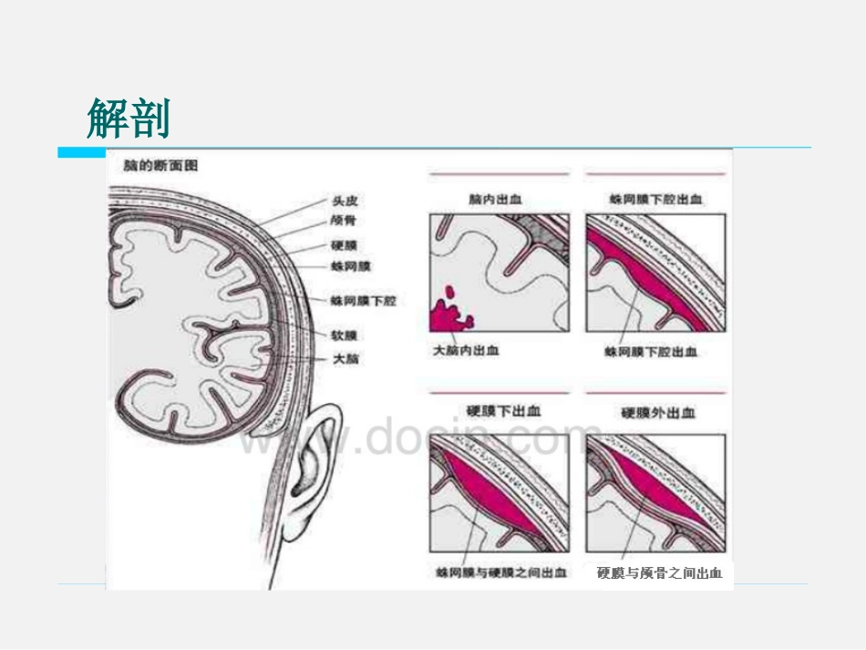 神经外科引流管的护理_第3页