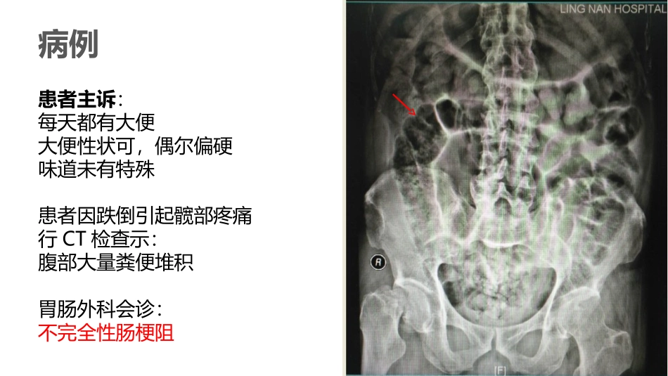 神经源性肠最终_第3页