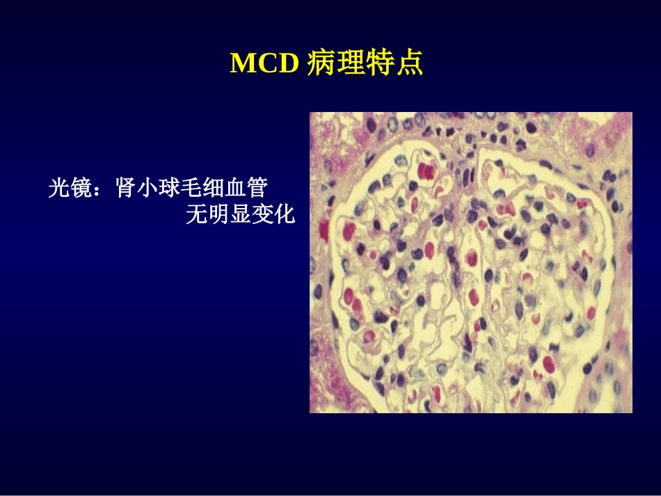 肾小球微小病变病_第2页