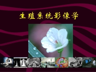 生殖系统影像诊疗学