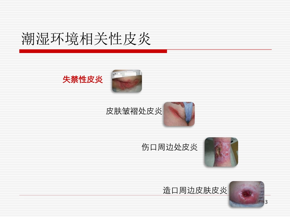 失禁性皮炎的预防和护理医学课件_第3页