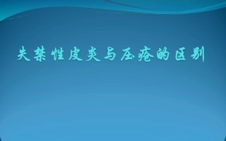 失禁性皮炎和压疮的区别
