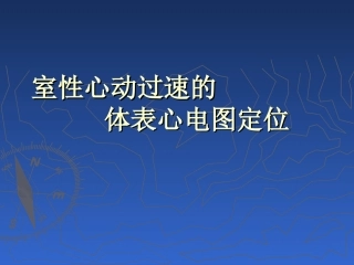 室性心动过速的体表心电图定位剖析