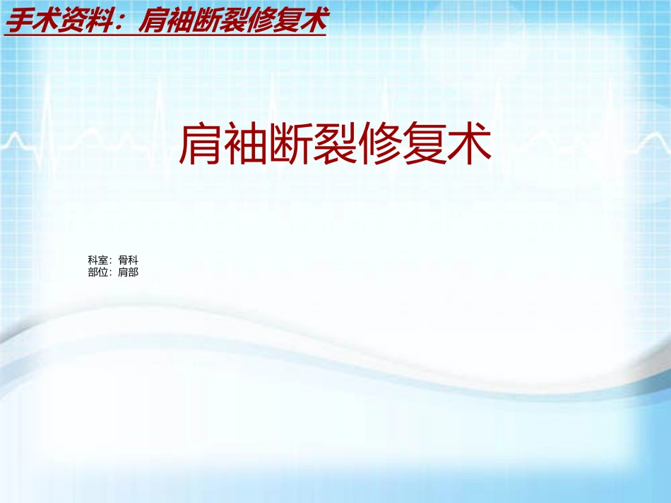 手术讲解模板肩袖断裂修复术_第2页
