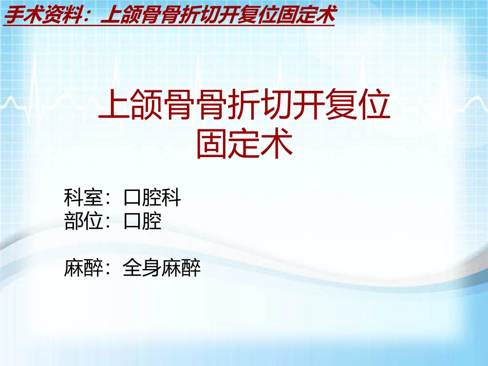 手术讲解模板上颌骨骨折切开复位固定术_第2页