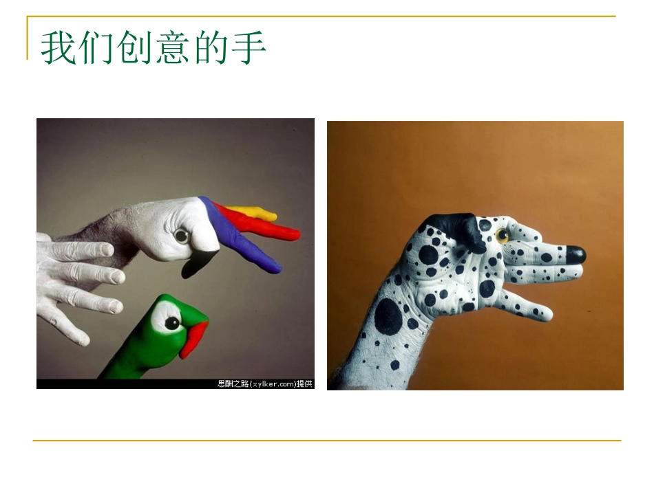 手外伤的护理和康复_第3页