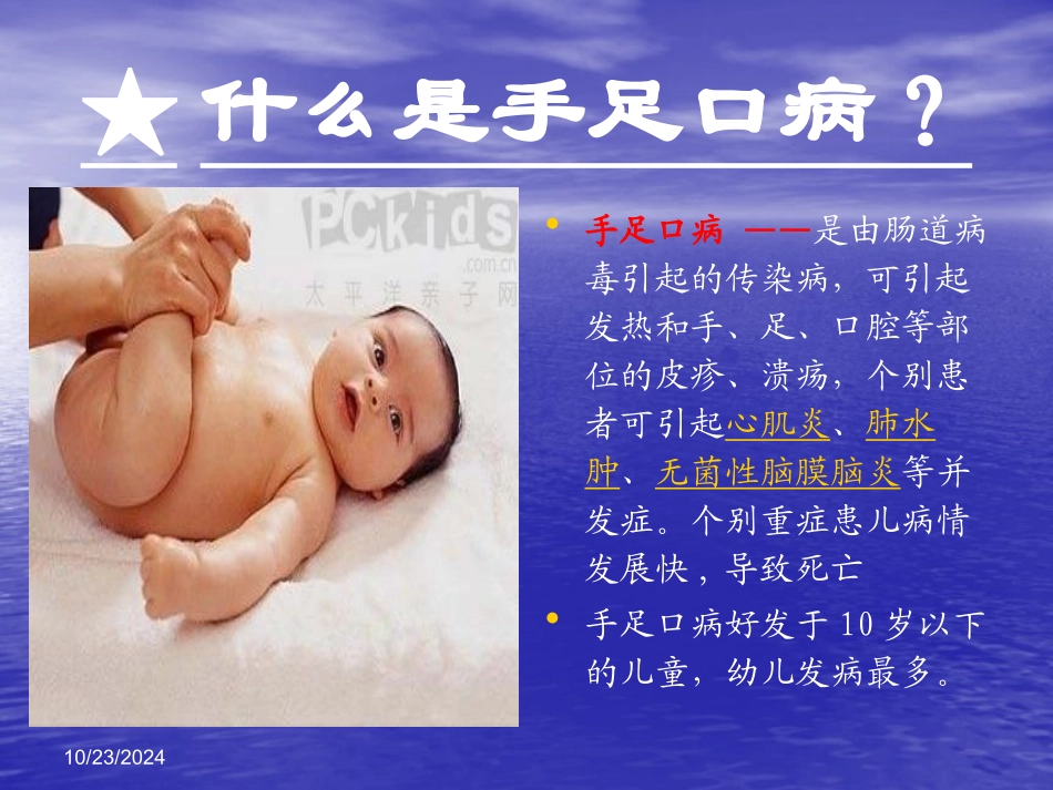 手足口病防治知识讲座_第2页