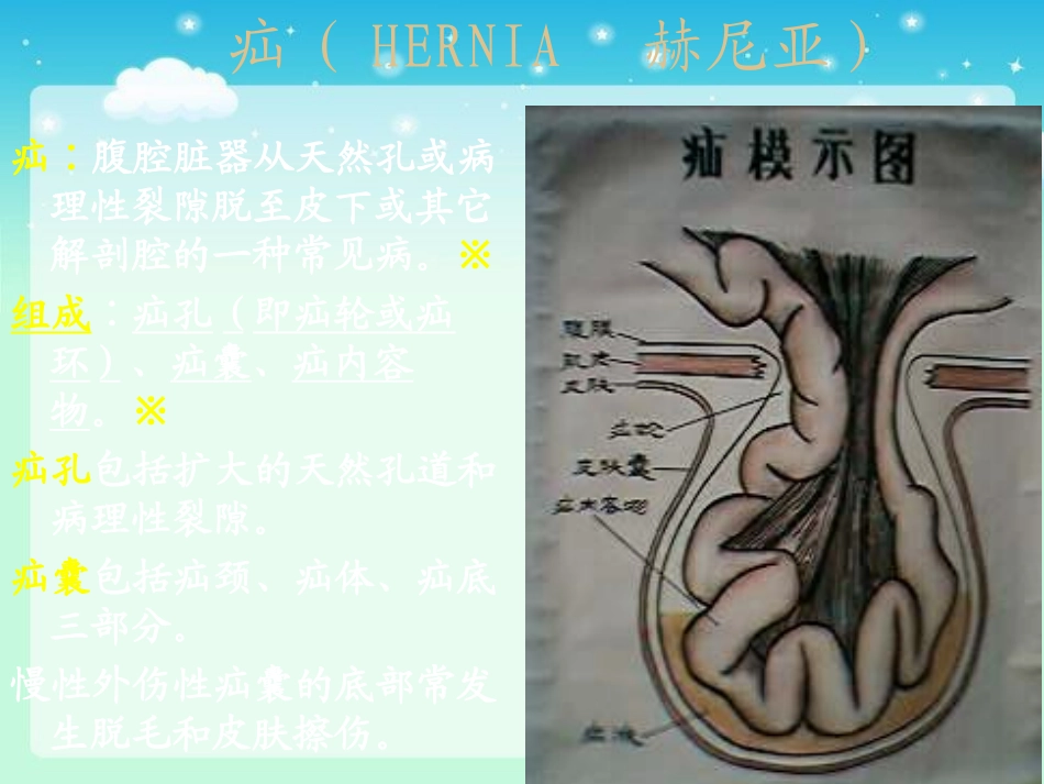 兽医外科学家畜疝_第2页