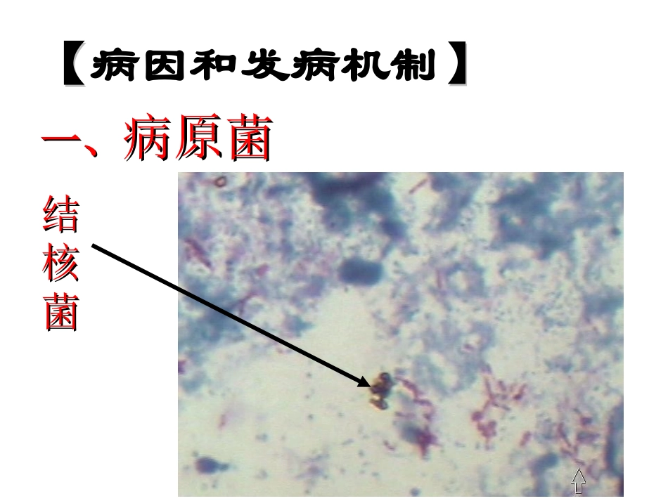 四一班预防肺结核课件_第3页
