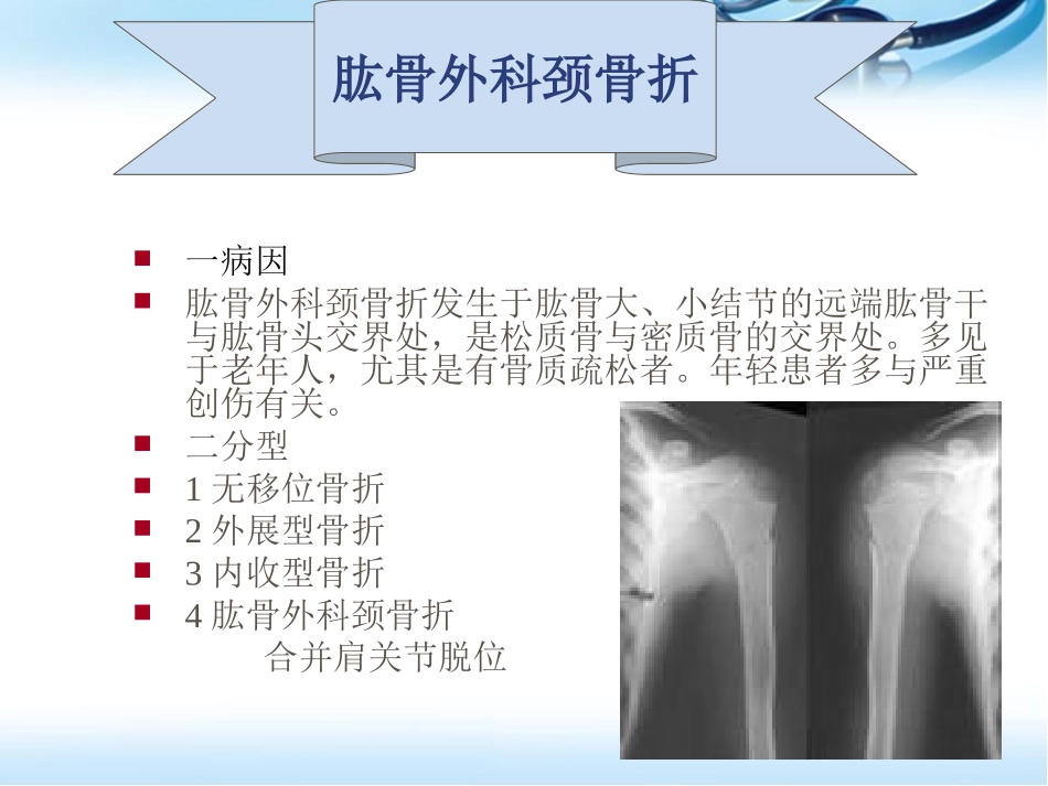 四肢骨折的护理参考课件_第2页