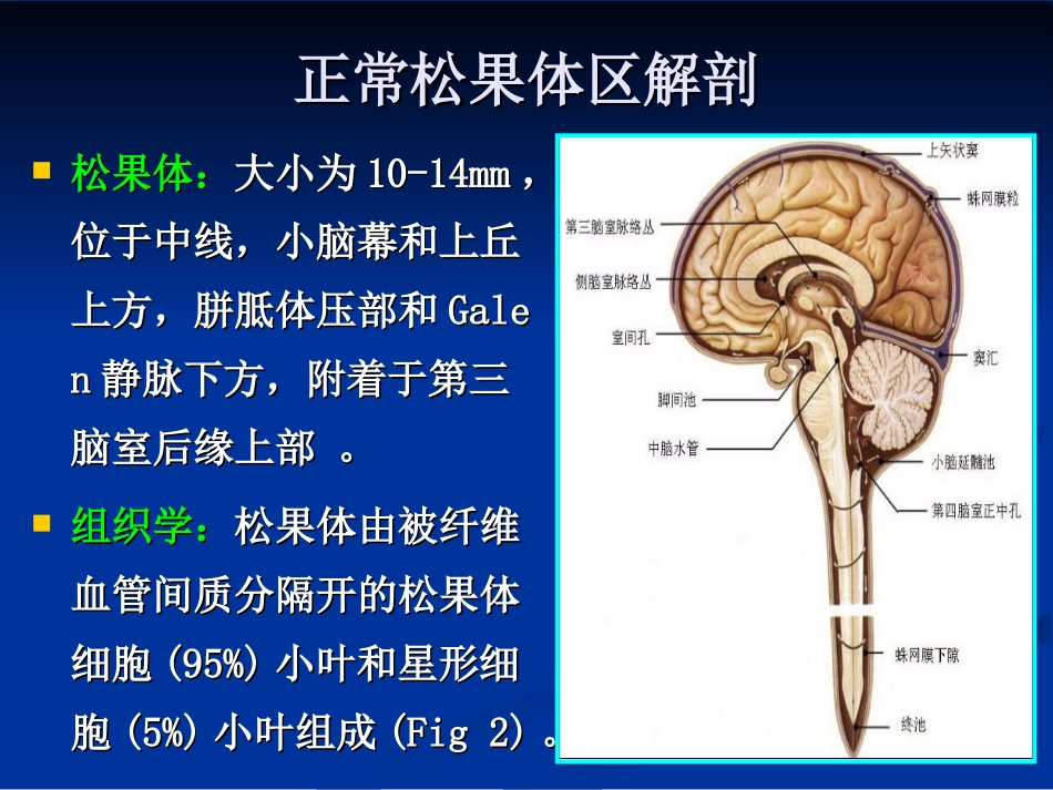 松果体区肿瘤_第2页
