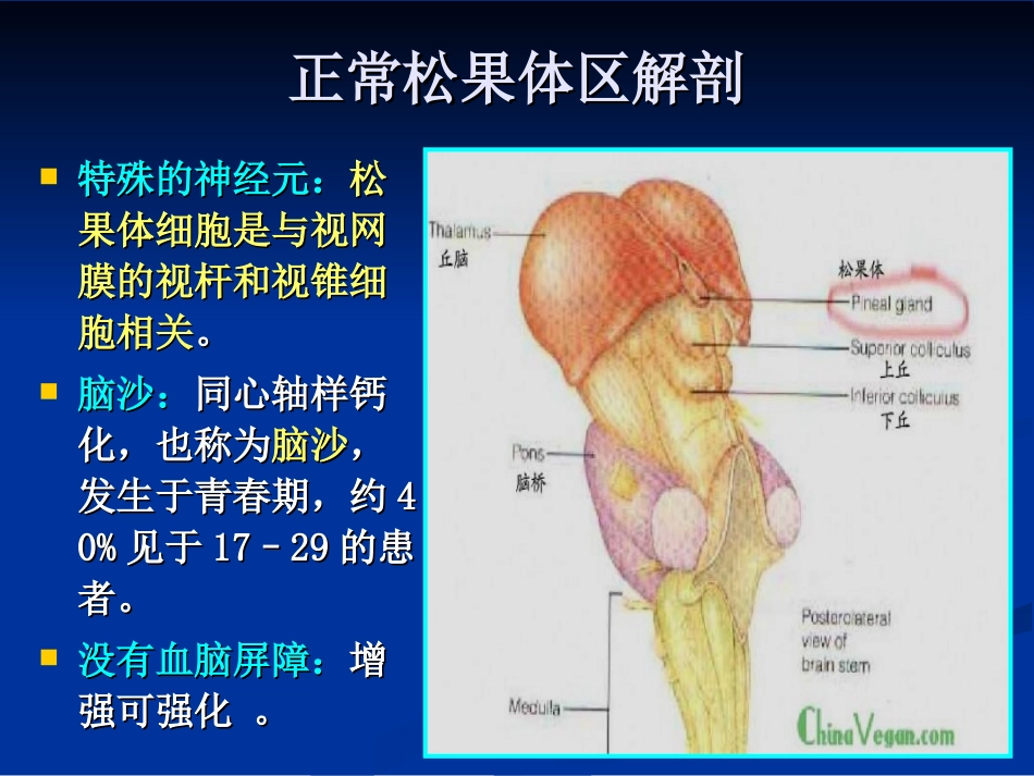 松果体区肿瘤_第3页