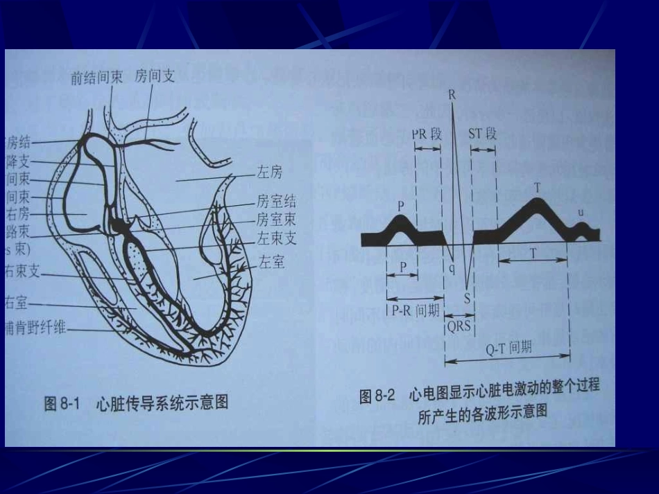 胎儿心律失常的超声诊疗_第2页