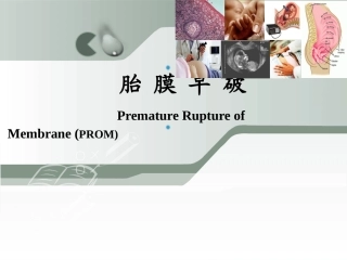 胎膜早破胎膜早剥和前置胎盘总结