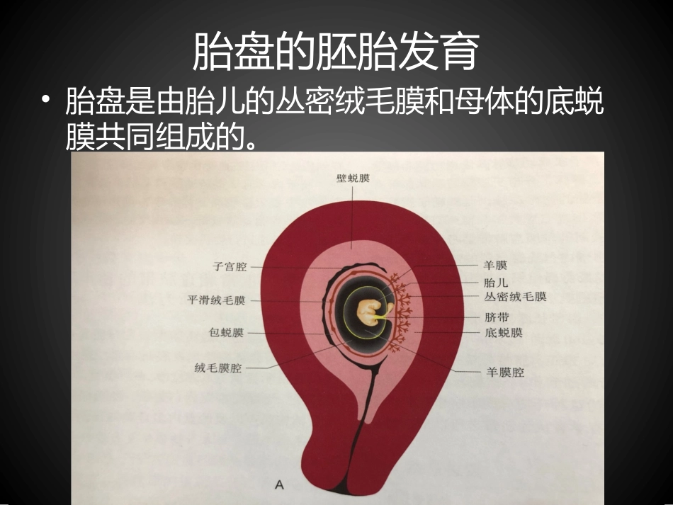 胎盘早剥超声诊疗_第2页