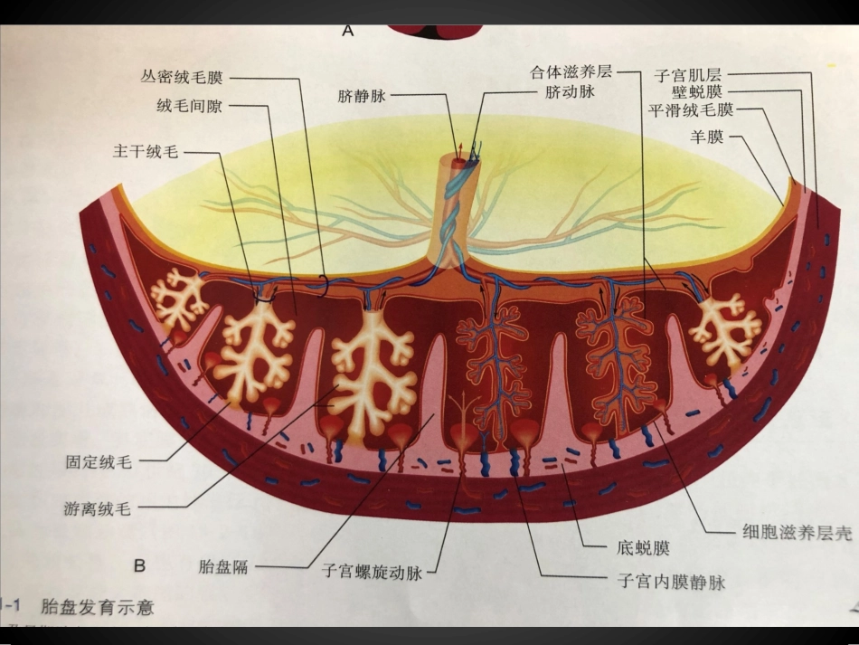 胎盘早剥超声诊疗_第3页