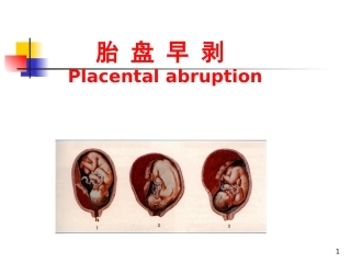 胎盘早剥疾病查房