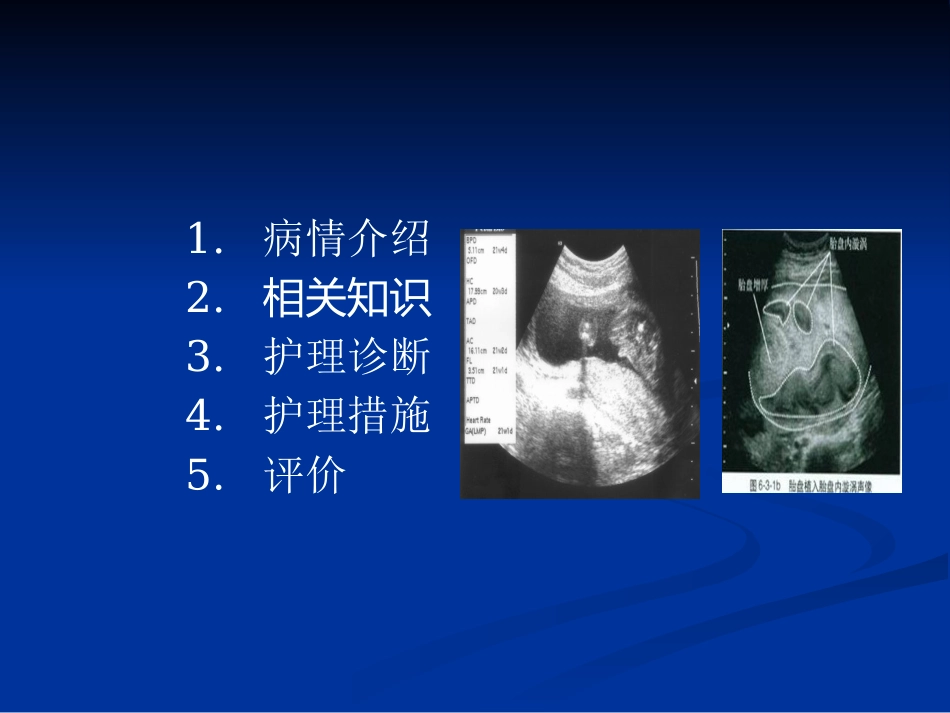 胎盘植入病人的护理新_第2页