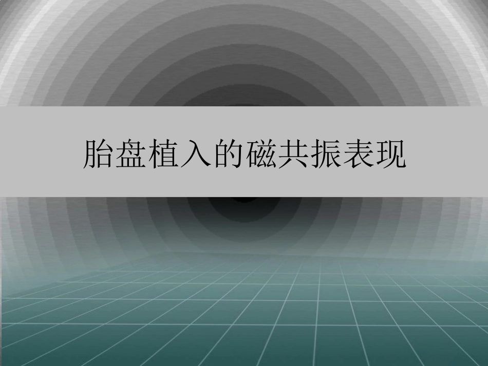 胎盘植入的MRI表现优秀医学课件_第1页