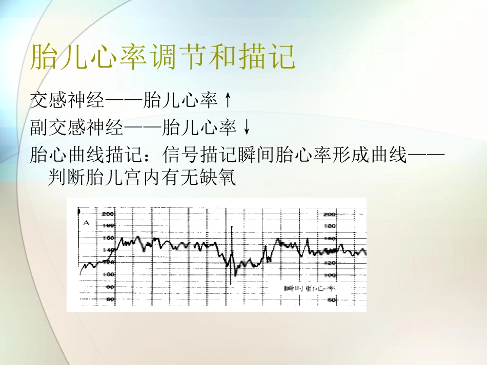 胎心监护及判读参考课件_第2页