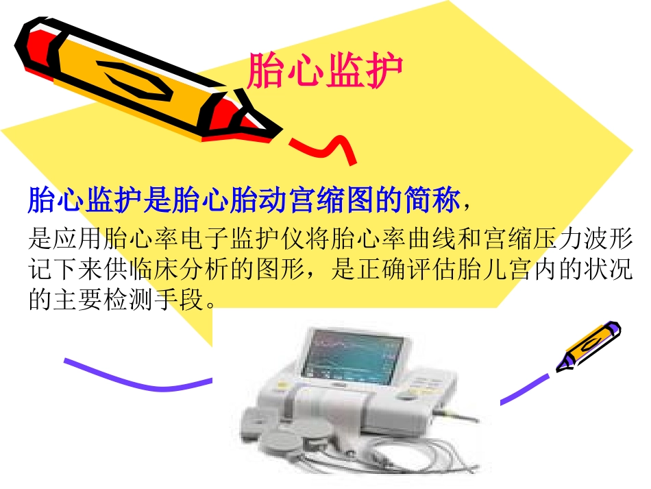 胎心监护课件详解_第1页