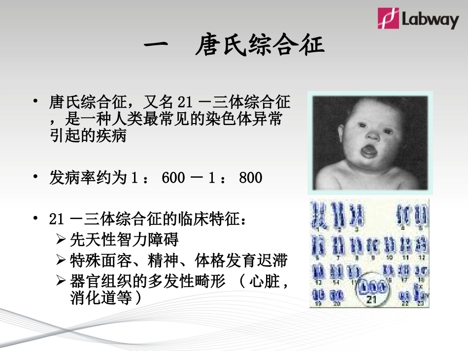 唐氏筛查检测的要求和临床应用_第2页