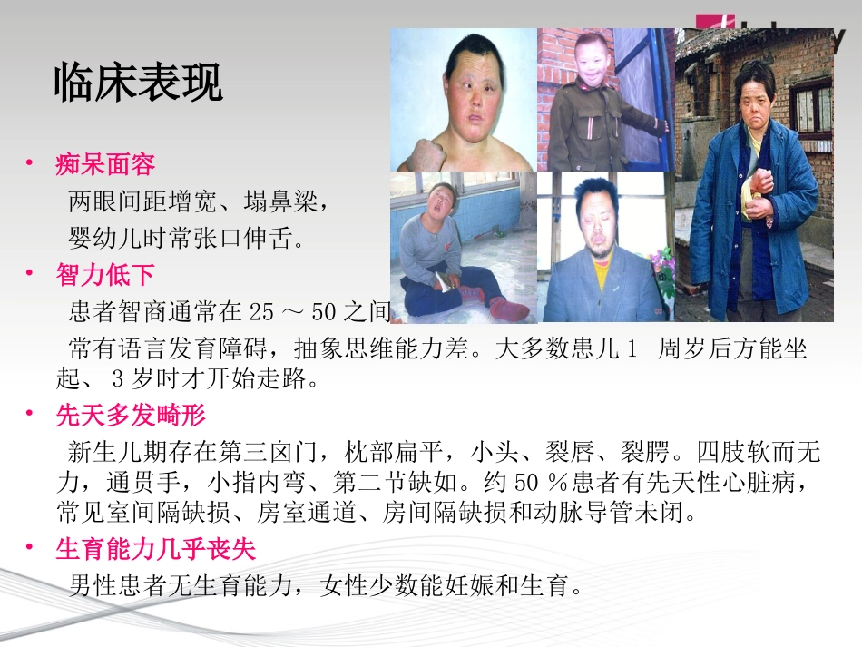 唐氏筛查检测的要求和临床应用_第3页