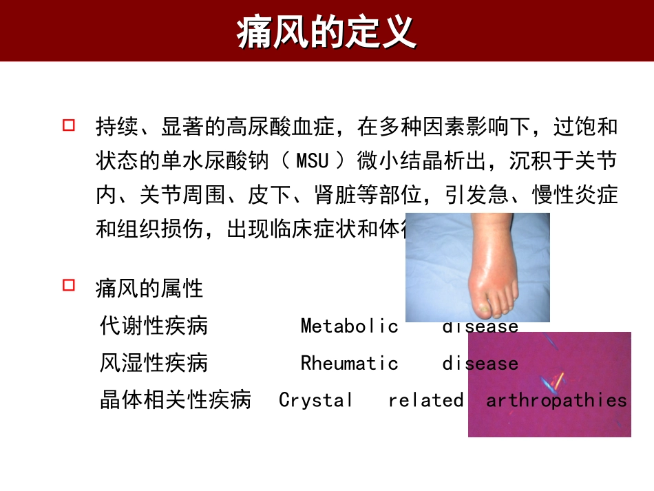 痛风的中西医诊疗_第2页